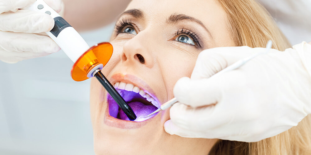 Dental Bonding Sudbury