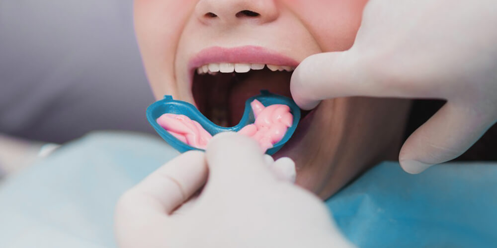 Fluoride Treatment Sudbury
