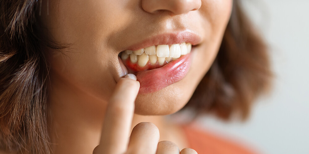 Periodontal Therapy Sudbury